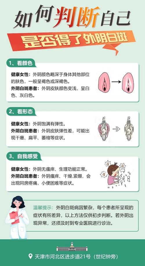 什么是妇科白班-什么是妇科白班病症状