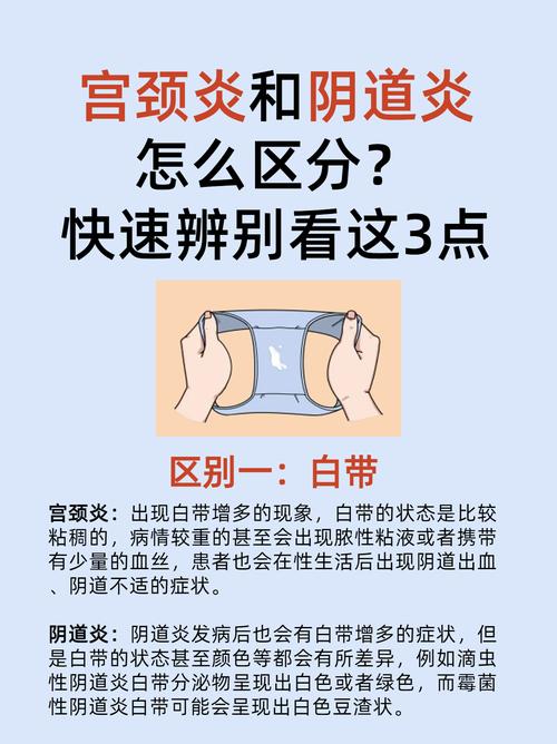 什么是妇科炎症-什么是妇科炎症,妇科炎症都有哪些