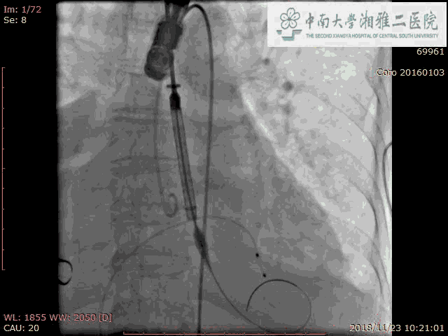 tavr品牌_tavr手术多少钱
